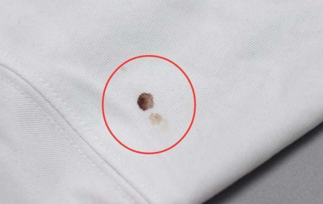 干洗店去污渍小妙招,特别难洗的污渍干洗店怎么处理