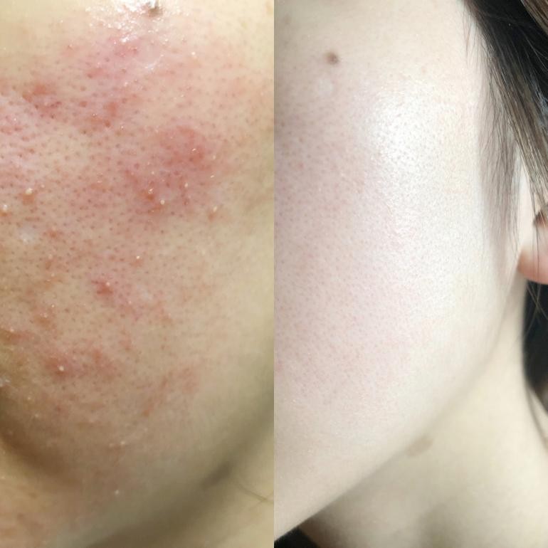 孕妇叶酸护肤品,孕妇专用叶酸护肤品