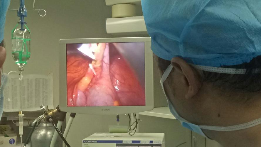 八十岁老人肝癌可以手术风险大吗,肝癌扩散怎么治疗治疗方案是什么