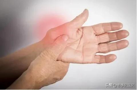 涨知识药店,四妙丸有哪些神奇功效