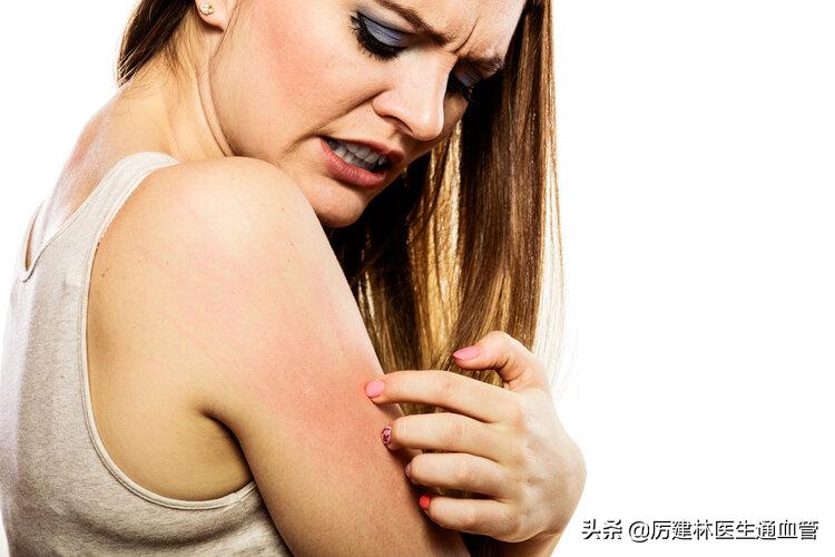 红霉素软膏和红霉素眼膏有何区别,红霉素软膏和红霉素眼膏具体区别