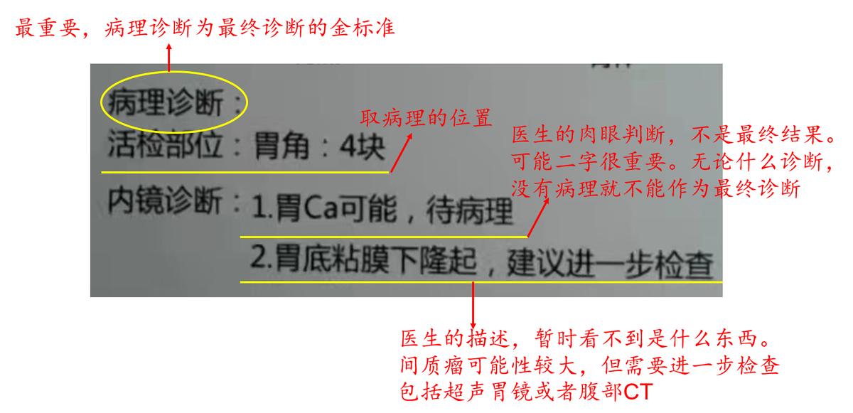 初学者怎样学习胃镜的操作手法,胃镜怎么做的过程图片解说
