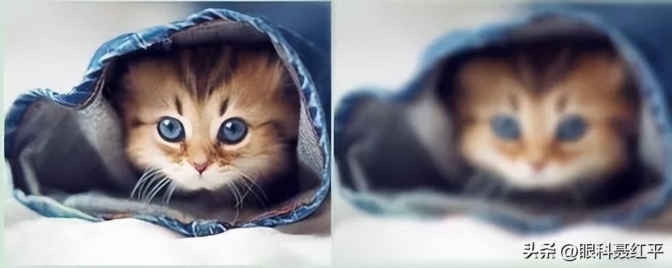 黄斑病变怎么预防,戒烟戒酒可以预防眼睛黄斑病变吗