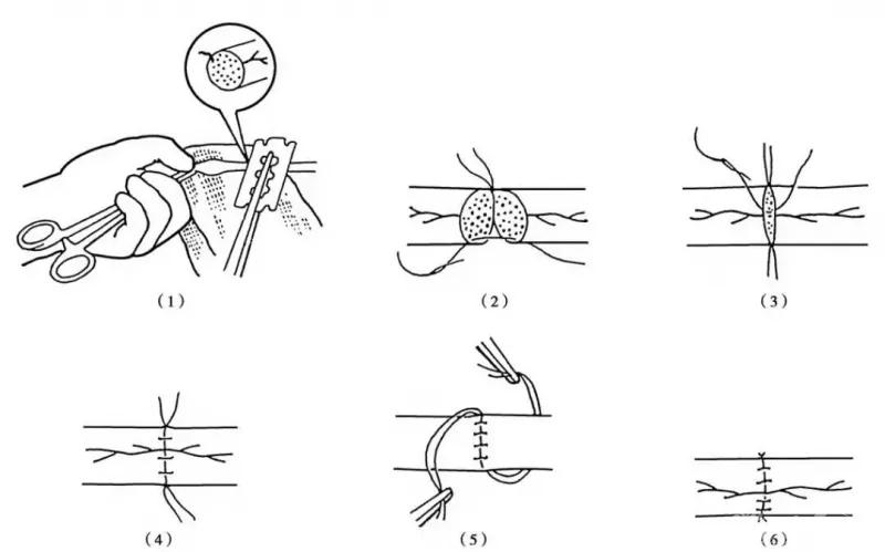 修复神经的最好方法,神经修复的最佳时间表