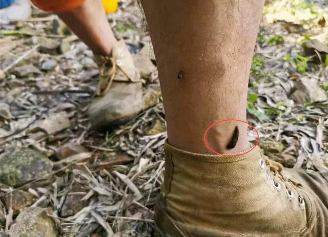 蚂蟥被吸进肚子里还能存活吗,山里的泉水有蚂蟥吗