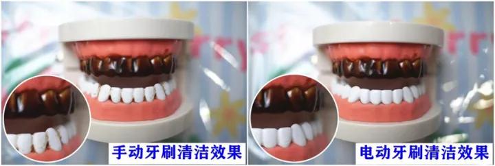 电动牙刷推荐欧乐毕,电动牙刷飞利浦和欧乐b哪个好用