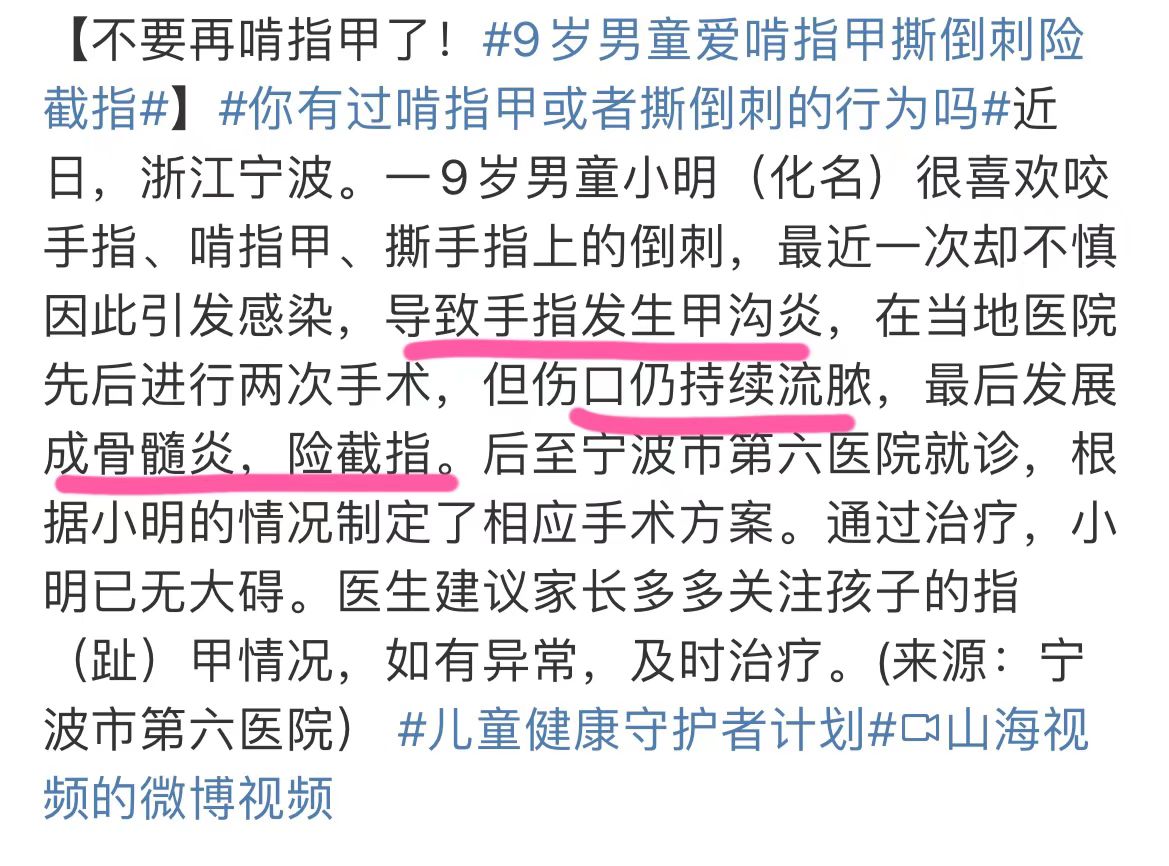 8岁篮球小孩詹姆斯,詹姆斯咬手指原因