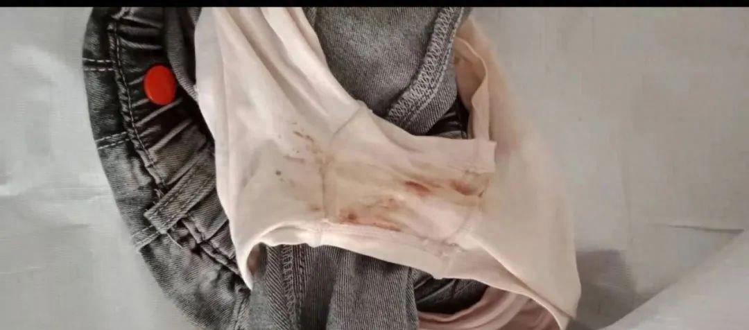 南宁一4岁女童上幼儿园疑似被猥亵，*裤内**上曾有血迹！