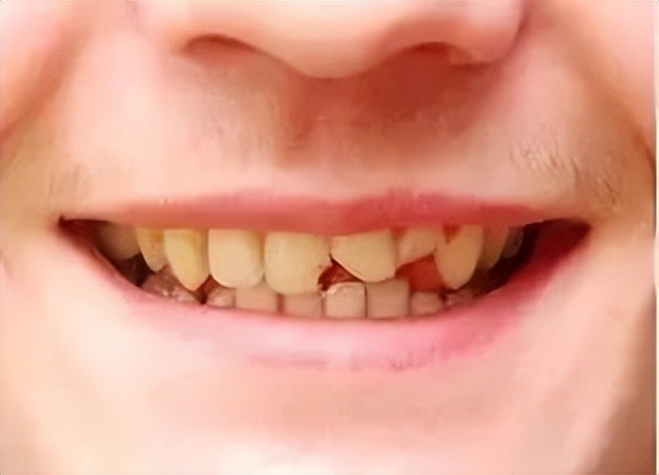 开学了学生们看到了什么,看看开学后孩子们的状态吧