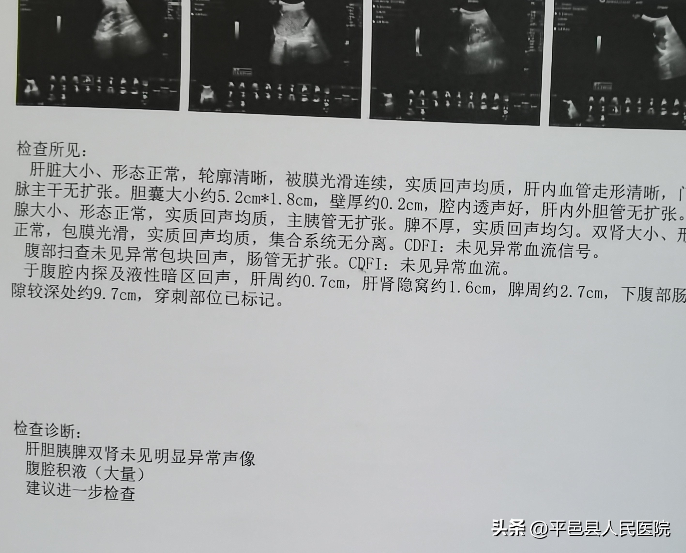 双十年华突发严重多发外伤多科协作联合手术成功救治