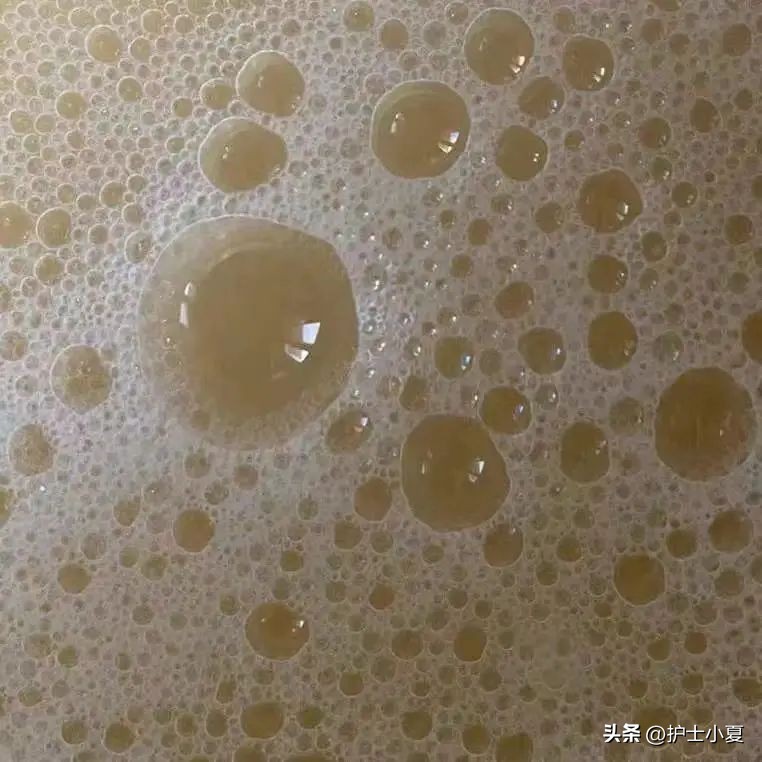 妇科病裤子总是湿湿的,例假过后裤子老是湿湿的