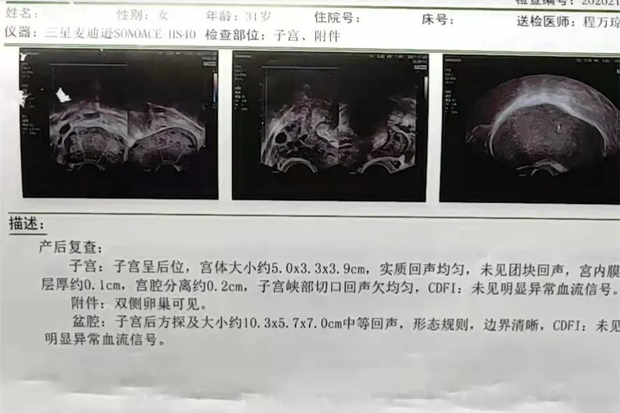 雅安恒博医院手术多少钱,雅安恒博医院妇产院区