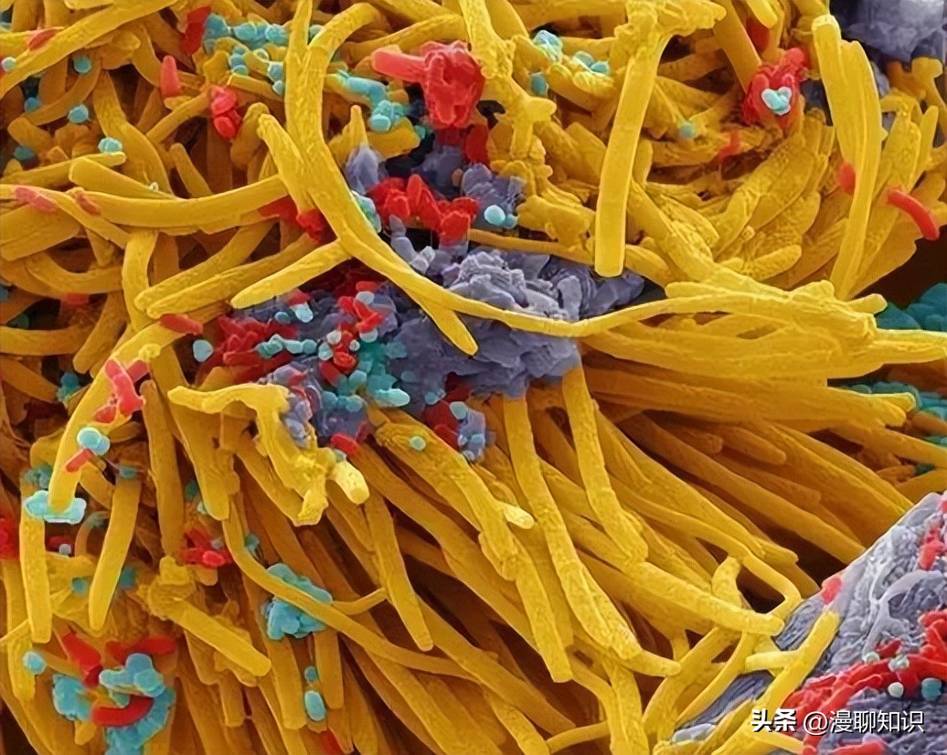 细菌感染会影响体内胰岛素吗,植物乳杆菌会对人体有影响吗