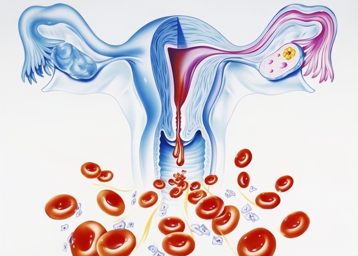 月经结束后为什么有褐色的分泌物,月经结束后10天有褐色膜状分泌物