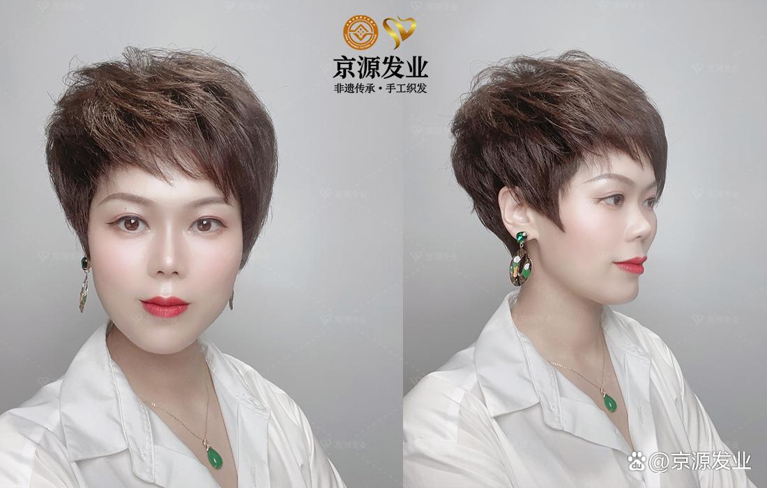 京源织发补发假发定制,头顶补发片男士