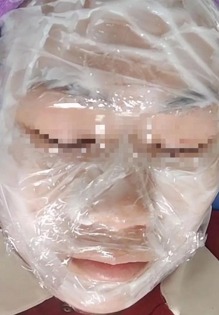 第一次打水光针爆痘,第一次打水光针反黑了