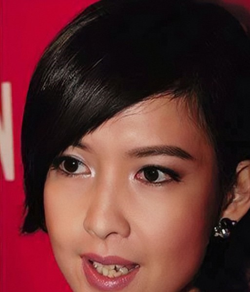 明星做烤瓷牙变凸嘴,明星烤瓷牙凸嘴