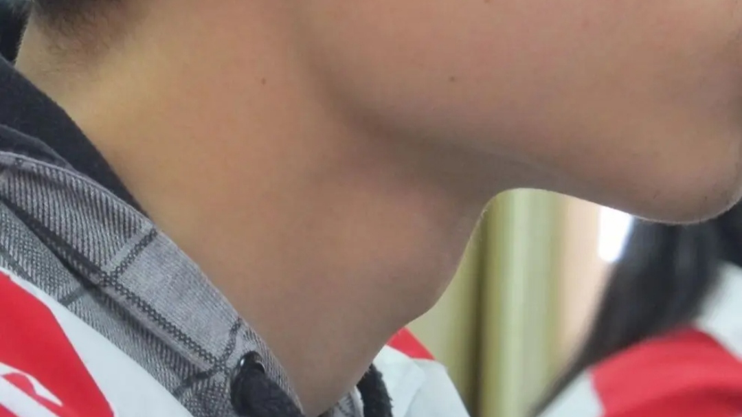 五十岁男人雄激素减少怎么办,男60岁后雄激素依然旺盛好吗