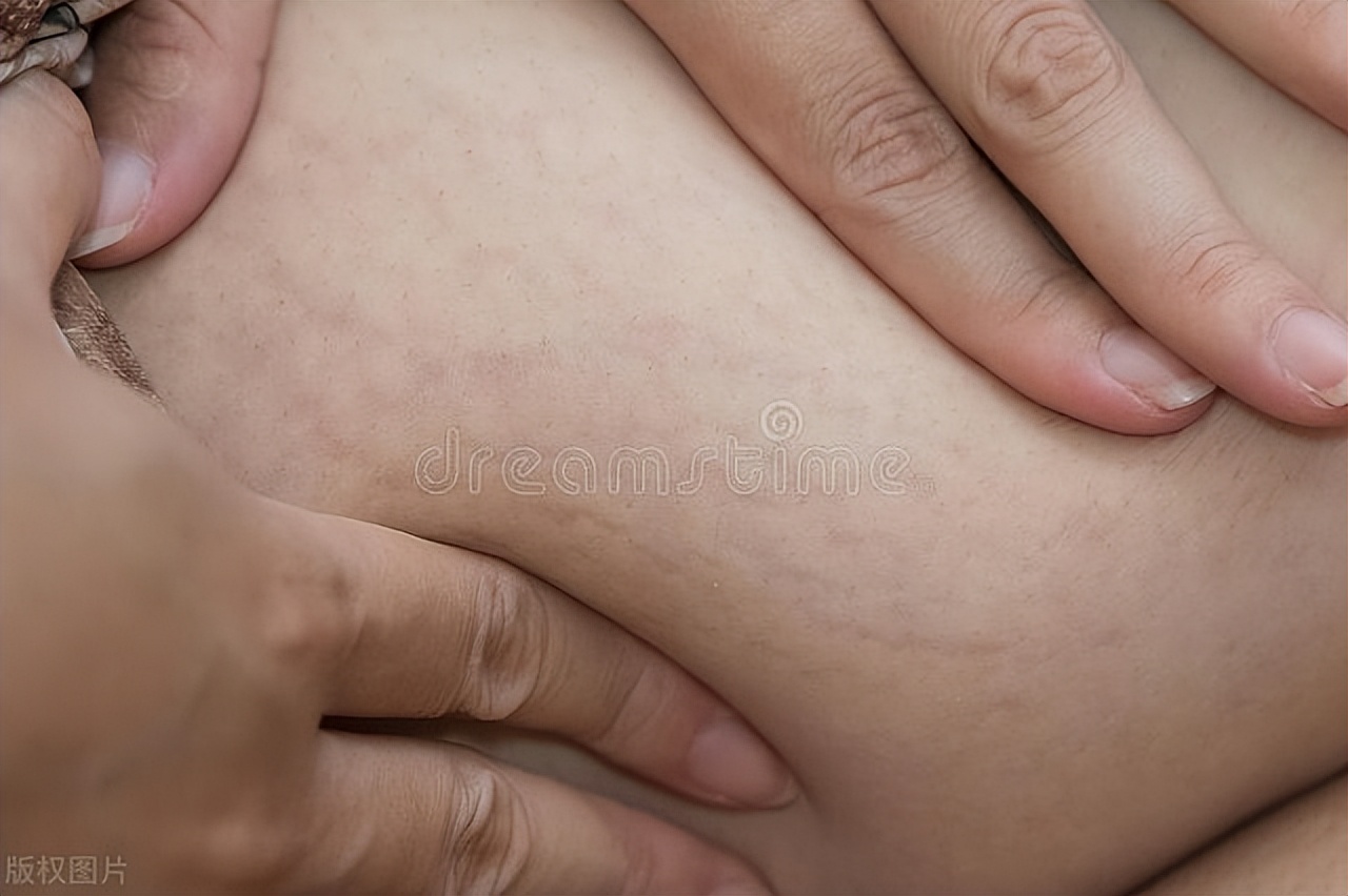 女性终身无孩率是什么,为什么现在年轻女性无法生育