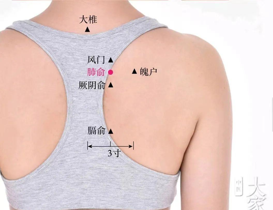 外感风寒拔罐治疗穴位,中医针灸放血治疗感冒