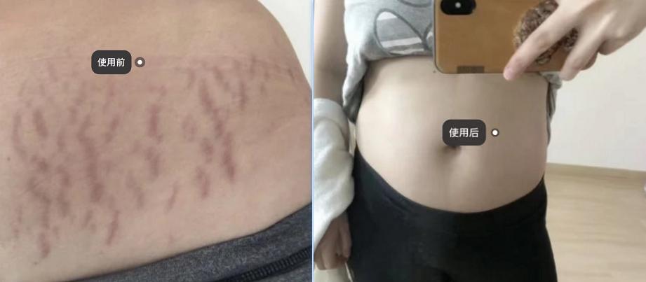 6款妊娠油推荐,妊娠油乳