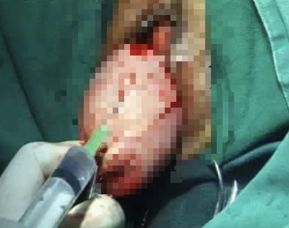 痛苦的疾病治疗,几种不需要治疗的妇科疾病