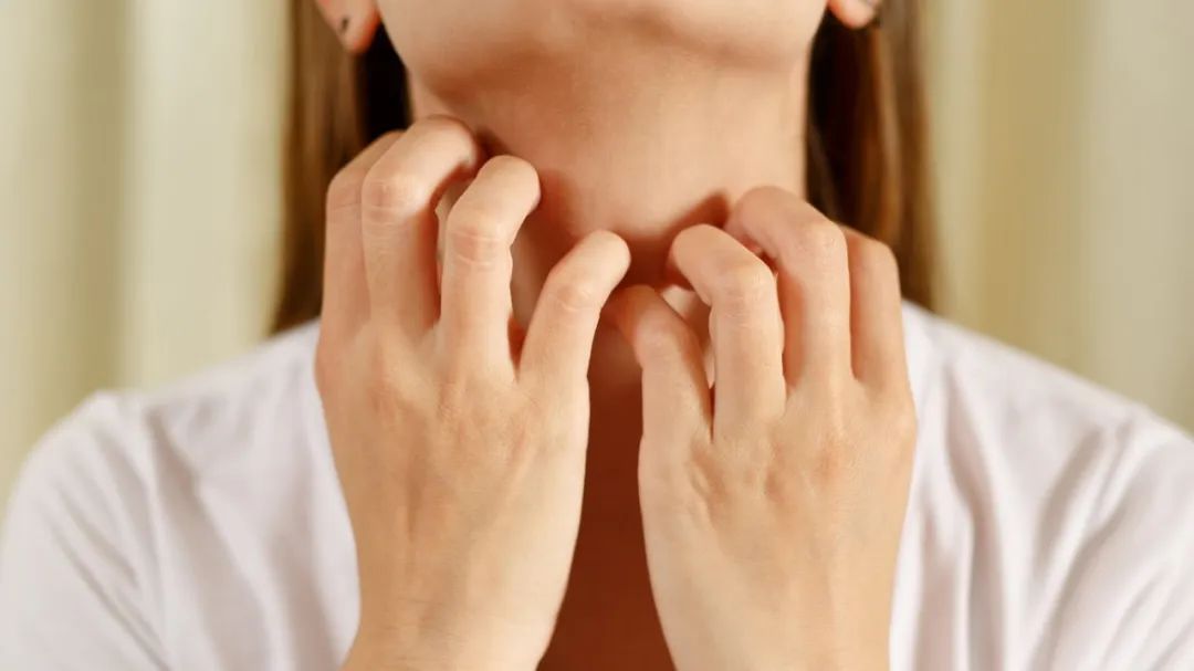 过敏体质反反复复的过敏该怎么办,过敏反复肌肤怎么修复