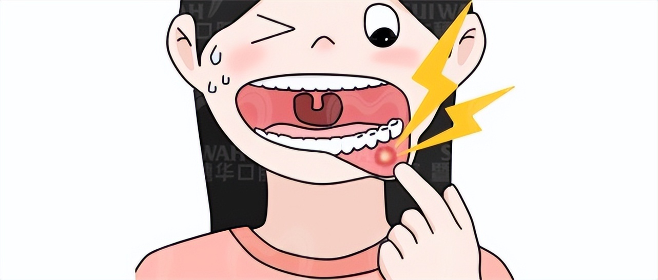 疫情期间牙疼厉害怎么办,疫情期间牙痛怎么办呢