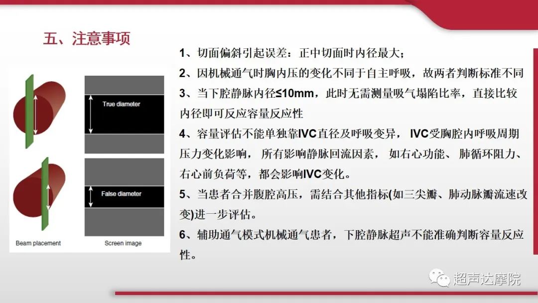 超声ppt课件大全,下腔静脉彩超评估容量