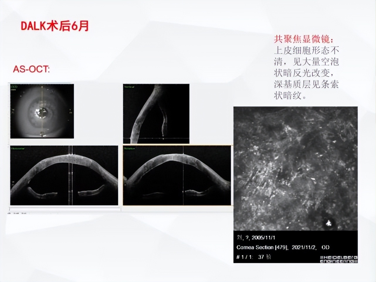 邓志宏几号坐诊,湘雅附三眼科邓志宏简历