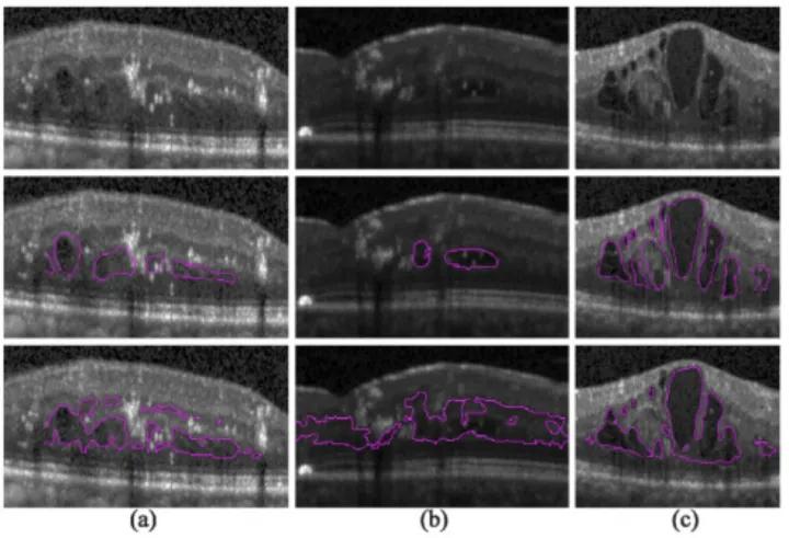 目标检测数据集采集,目标检测图像数据集