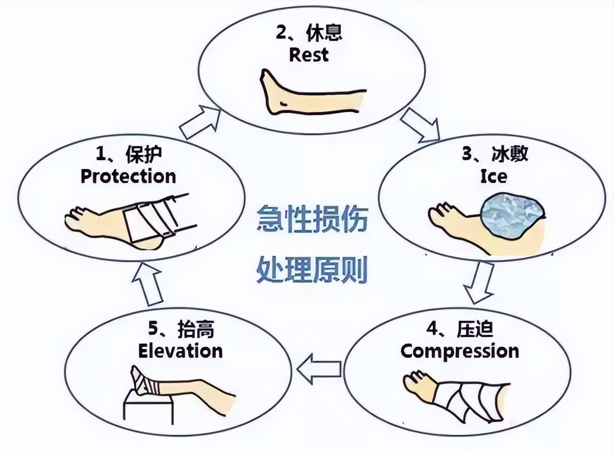 反复崴脚不重视得了创伤性关节炎,多次扭伤同一个位置怎么治