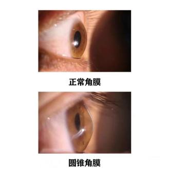 郑州眼科医院全飞秒设备,郑州视光眼科的仪器