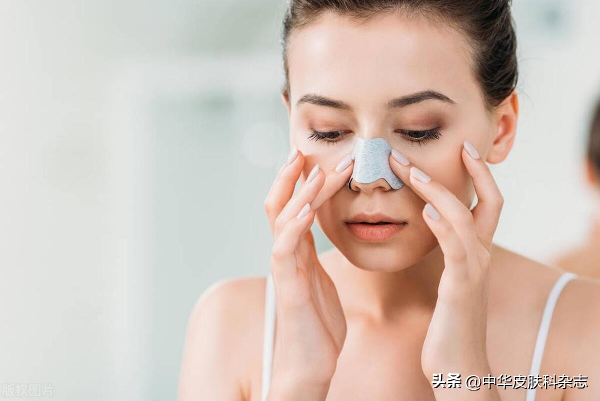 鼻翼红斑有鳞屑,鼻翼有斑是怎么回事