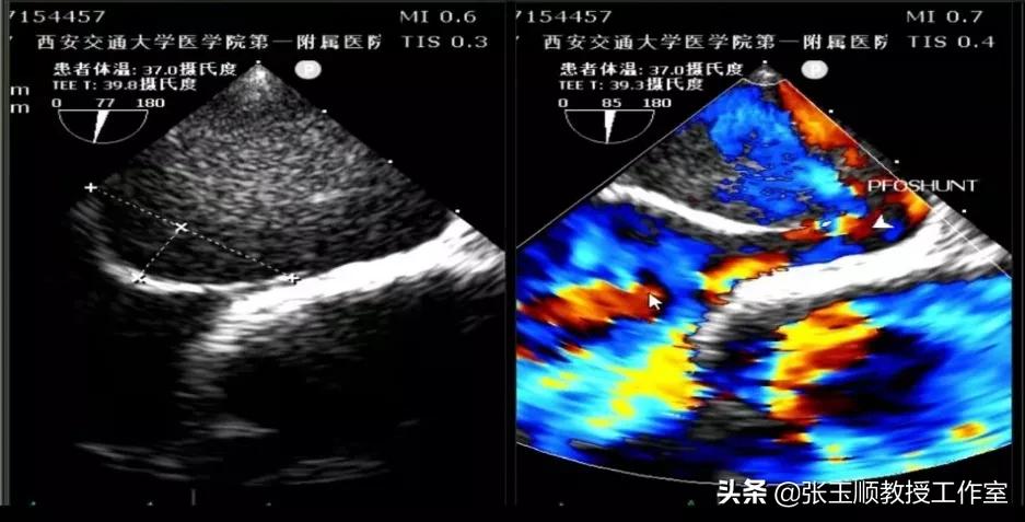 咳嗽不停该咋办导致晕厥,反复咳嗽一个月了是什么原因