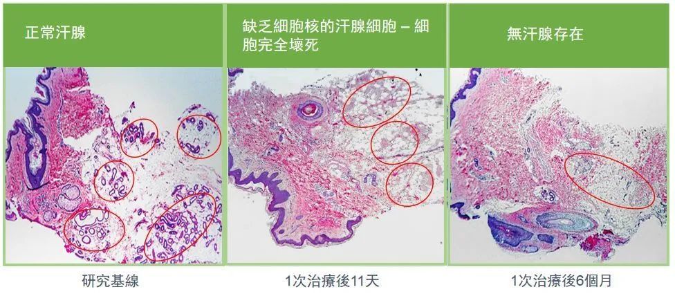 给夏天爱出汗的你：轻松止汗香汗指南