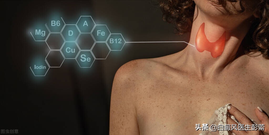 正确的补充铜元素才能更好的帮助白癜风复色