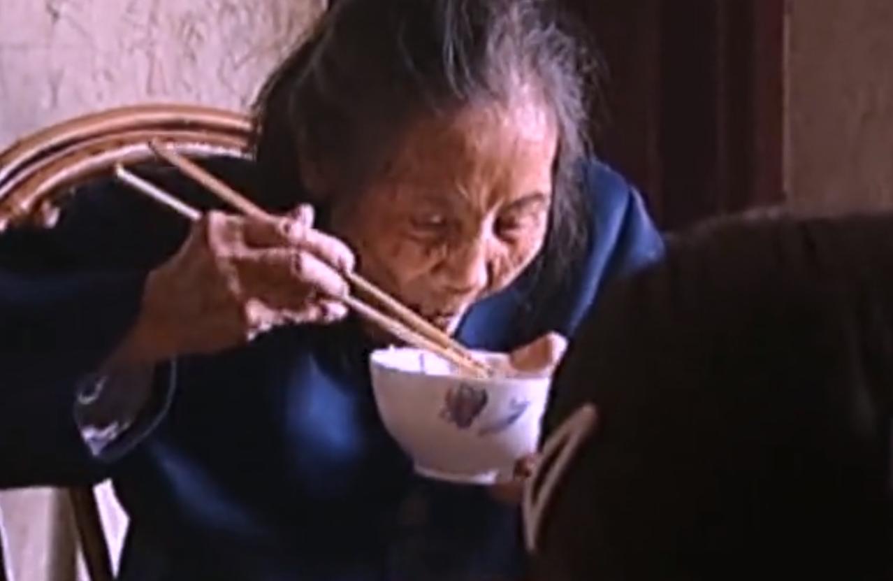 2007年四川90岁老妇，腹中怀子60年未生，后检查发现胎儿没有腐烂