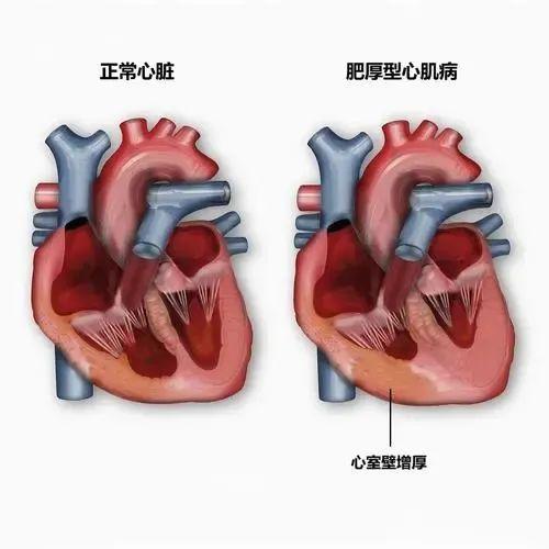 52岁男高烧不退原因,五十岁男人高烧不退怎么办