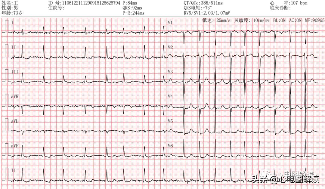 蹇冩埧棰ゅ姩鍗掍腑,鍒濆彂蹇冩埧棰ゅ姩