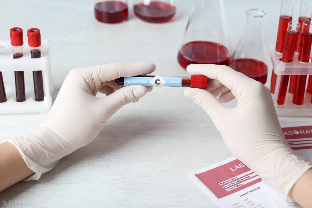 卵巢早衰能逆转吗？医生：出现5个症状，或是身体发出预警信号