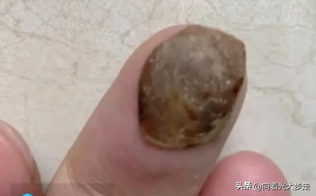 湘雅医院事件是怎么被曝光的,湘雅丑闻