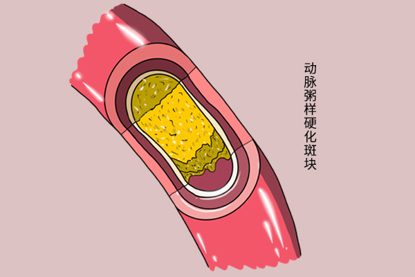 蔬菜皇后洋葱怎么吃,蔬菜皇后与蔬菜