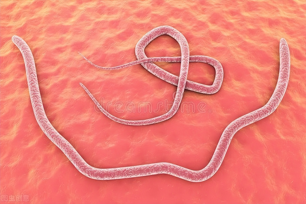 体内有绦虫吃什么食物,女子体内排出4.59米长的绦虫