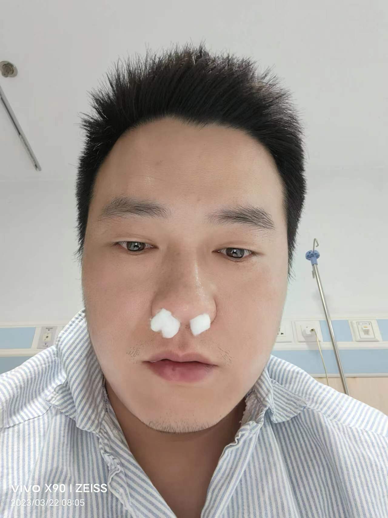 给鼻窦炎打了个措手不及------记与鼻窦炎的抗争二