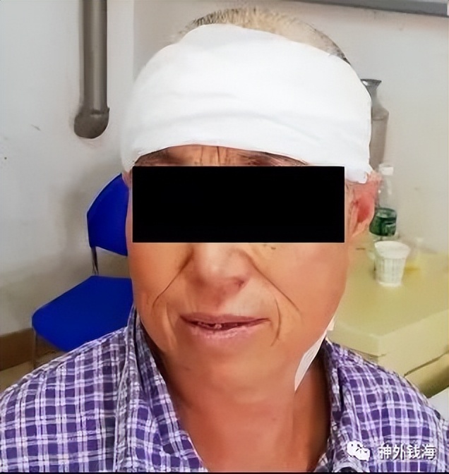 “歪脖子”是种病,需要手术治疗