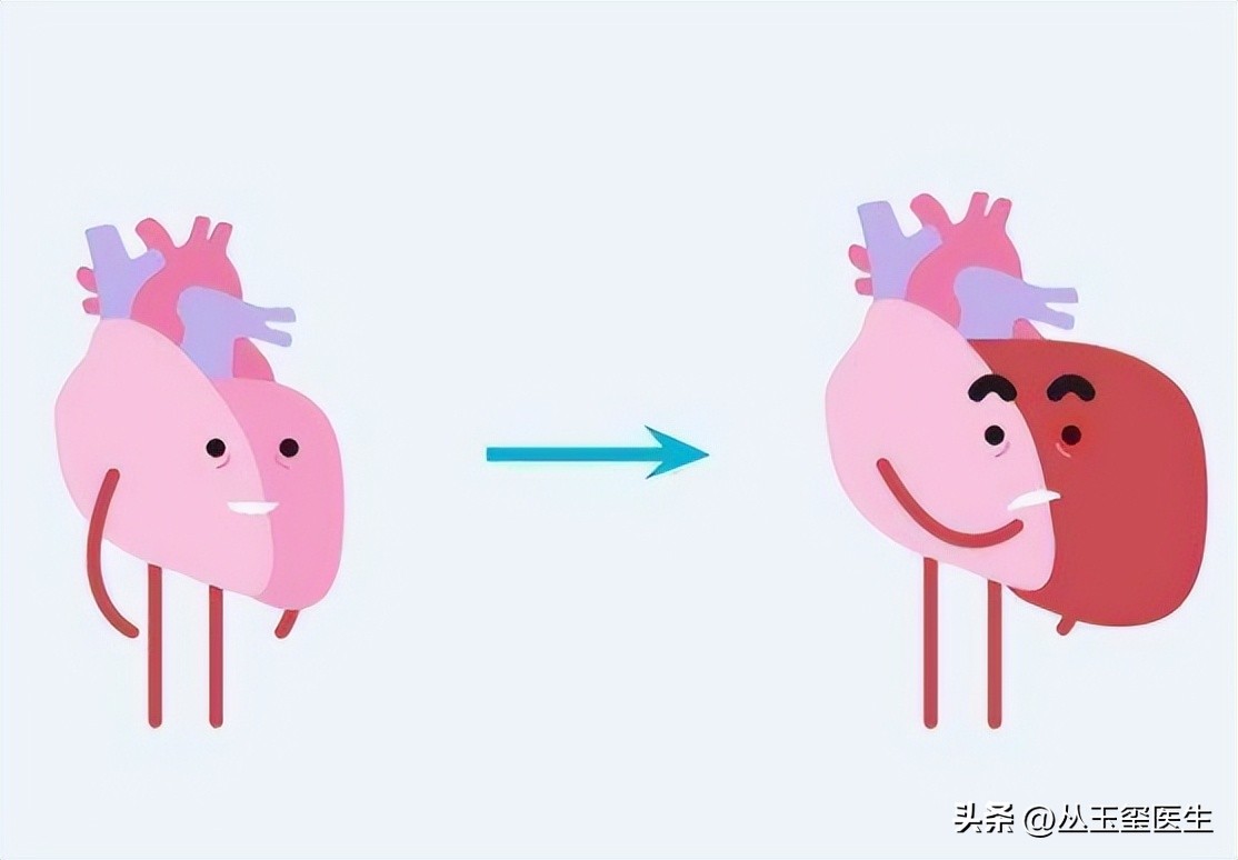 尿毒症死亡主要原因-心血管疾病，超声检查效果如何？