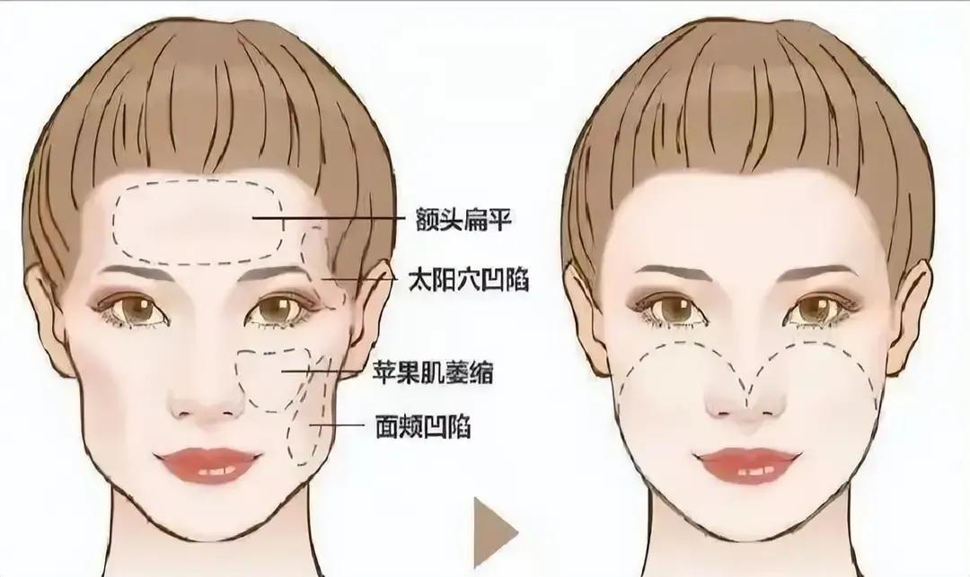 爆火的“轮廓固定”，如何花最少的*达钱**到最大效果，秒变“女神”