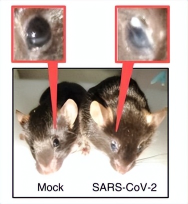 结膜炎好了以后眼睛还是经常流泪,结膜炎好了后眼睛会流眼泪
