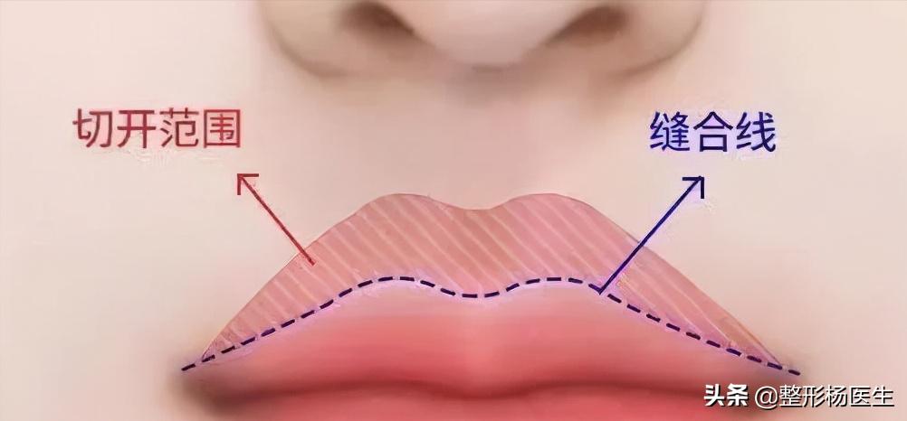 人中太长了好看吗,人中太长显老怎么办